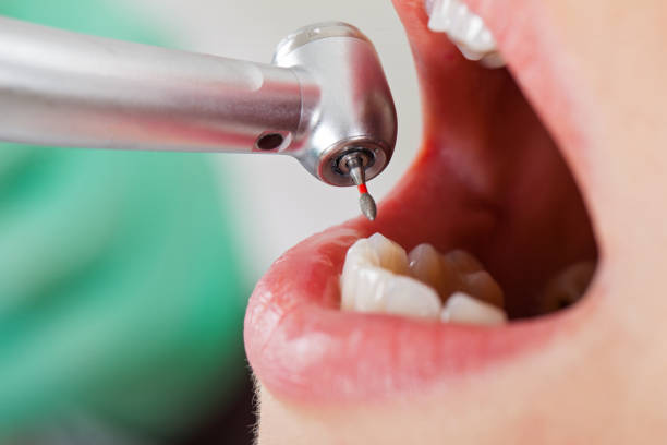 Best Pediatric Emergency Dentist in Indian River, MI